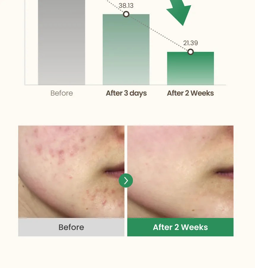 Axis-Y Dark Spot Correcting Glow Serum 50Ml